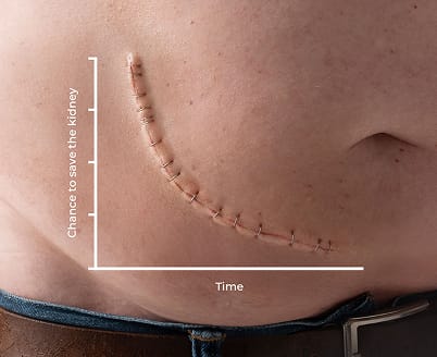 Chance to save the kidney over time