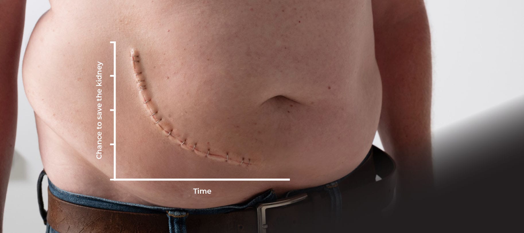 Chance to save the kidney over time